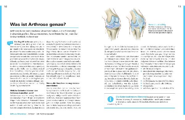 Aktiv leben mit Arthrose