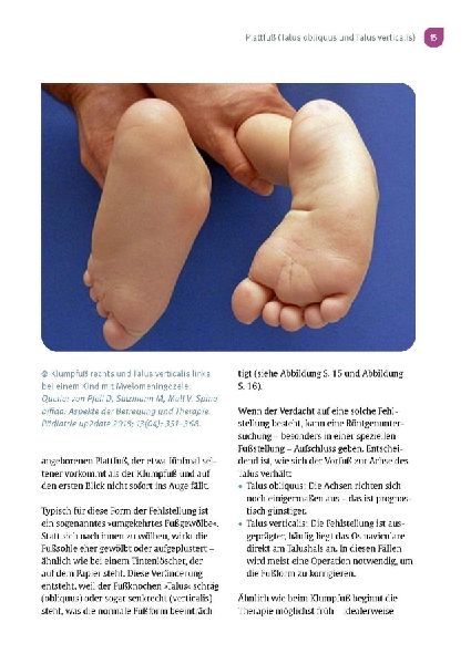 Aus der Praxis eines Kinderorthopäden