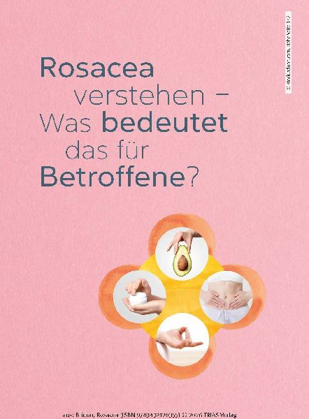 Rosacea