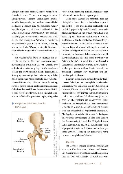 Expertenwissen: Arthrose