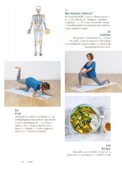 Expertenwissen: Arthrose