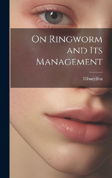 On Ringworm and Its Management