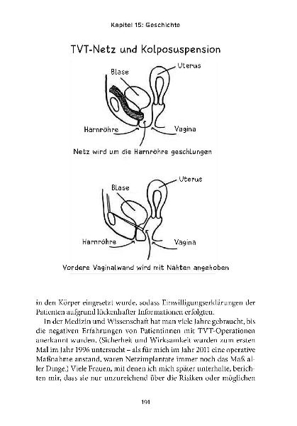 Ich bin nicht ganz dicht