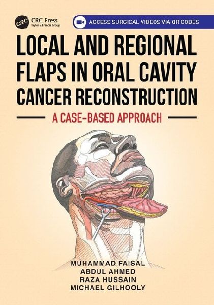 Local and Regional Flaps in Oral Cavity Cancer Reconstruction