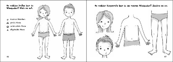 Wilma und die Windpocken - Das Bilder-Erzählbuch für Kinder, die Windpocken haben oder mehr darüber wissen wollen
