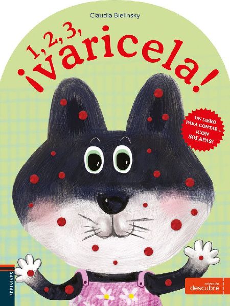 1, 2, 3, ¡varicela!