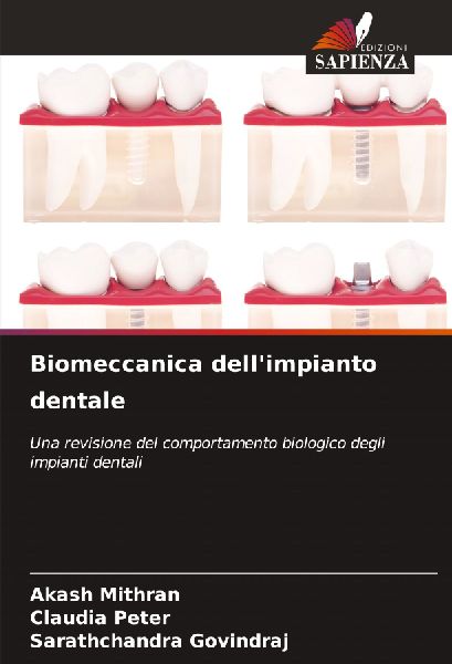 Biomeccanica dell'impianto dentale
