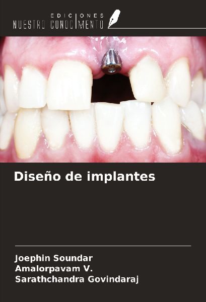 Diseño de implantes