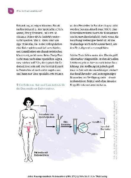 Frauengesundheit: Endometriose