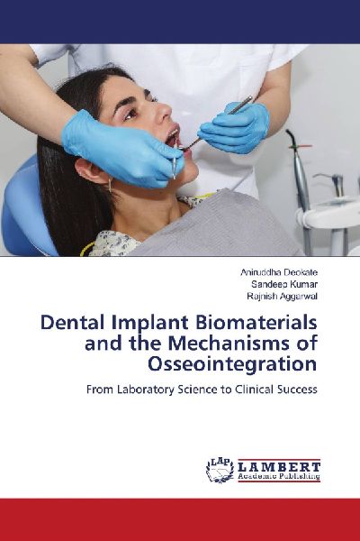 Dental Implant Biomaterials and the Mechanisms of Osseointegra...