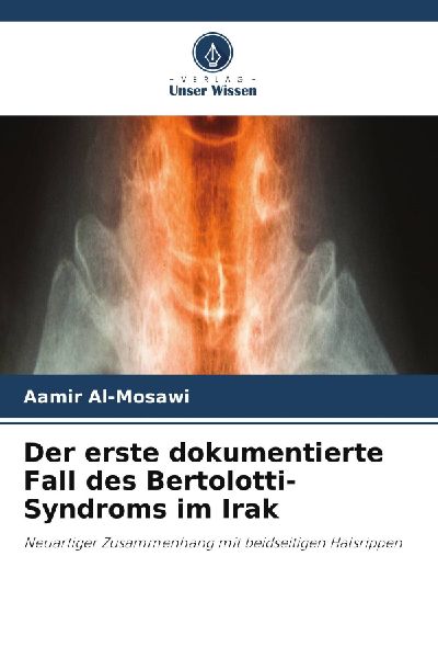 Der erste dokumentierte Fall des Bertolotti-Syndroms im Irak