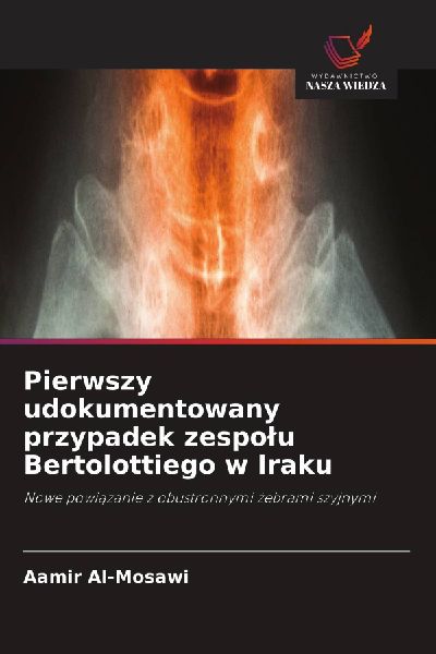 Pierwszy udokumentowany przypadek zespo¿u Bertolottiego w Iraku